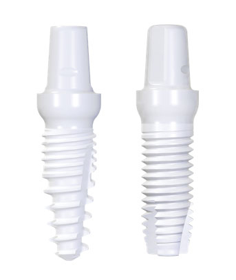 Implant dentaire en zircone - Cabinet dentaire du Dr Pascal Guillemin - Gouesnou Finistère