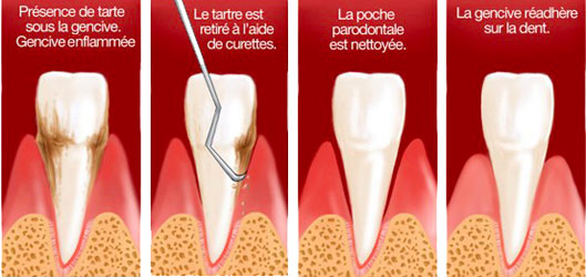 Cabinet dentaire du Dr Pascal Guillemin - Brest Finistère